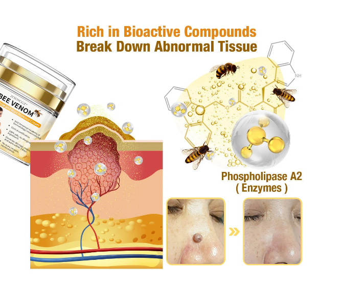 𝐁𝐞𝐞 𝐕𝐞𝐧𝐨𝐦 𝐌𝐨𝐥𝐞 𝐚𝐧𝐝 𝐖𝐚𝐫𝐭 𝐓𝐫𝐞𝐚𝐭𝐦𝐞𝐧𝐭 𝐂𝐫𝐞𝐚𝐦(👨‍⚕𝐀𝐀𝐃 𝐑𝐄𝐂𝐎𝐌𝐌𝐄𝐍𝐃𝐒)