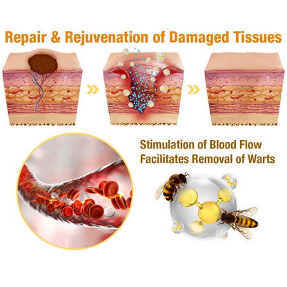 𝐁𝐞𝐞 𝐕𝐞𝐧𝐨𝐦 𝐌𝐨𝐥𝐞 𝐚𝐧𝐝 𝐖𝐚𝐫𝐭 𝐓𝐫𝐞𝐚𝐭𝐦𝐞𝐧𝐭 𝐂𝐫𝐞𝐚𝐦(👨‍⚕𝐀𝐀𝐃 𝐑𝐄𝐂𝐎𝐌𝐌𝐄𝐍𝐃𝐒)
